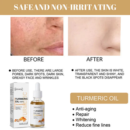 Turmeric Oil Face Serum - 30ml