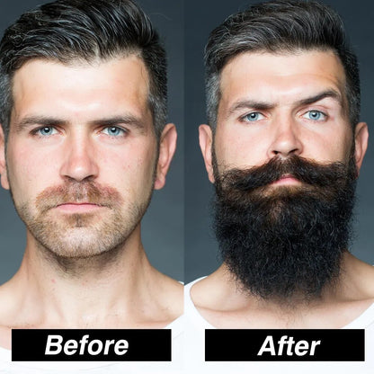 Professional Beard Growth Kit