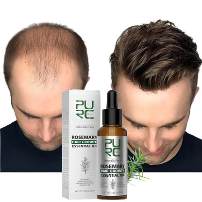 Rosemary Hair Growth Oil