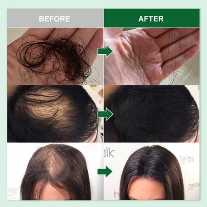 Rosemary Hair Growth Oil